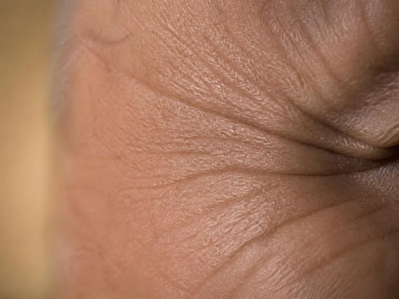 Piel madura con líneas y arrugas.